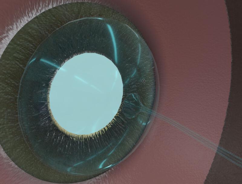 Internal anatomy of the human eye