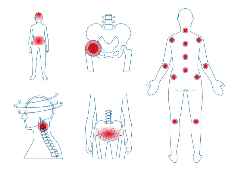 Illustrationer om smärta hos barn och ungdomar, ledvärk, fibromyalgi, cervikogena ryckningar, smärta i nedre delen av buken