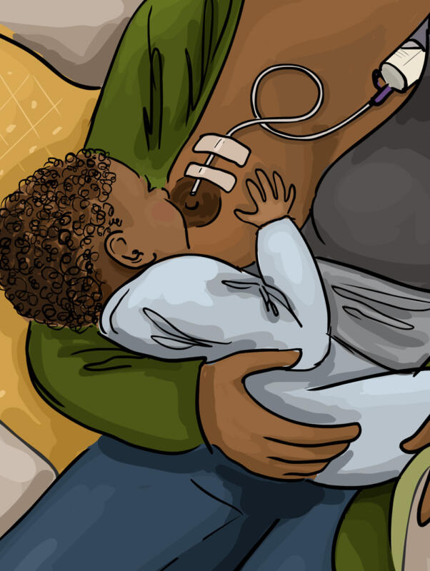 Close up illustration of a baby nursing with a supplemental tube.