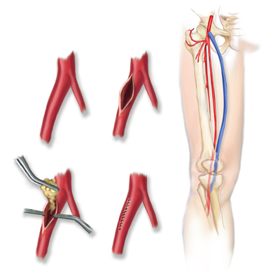 Medicals ilustration