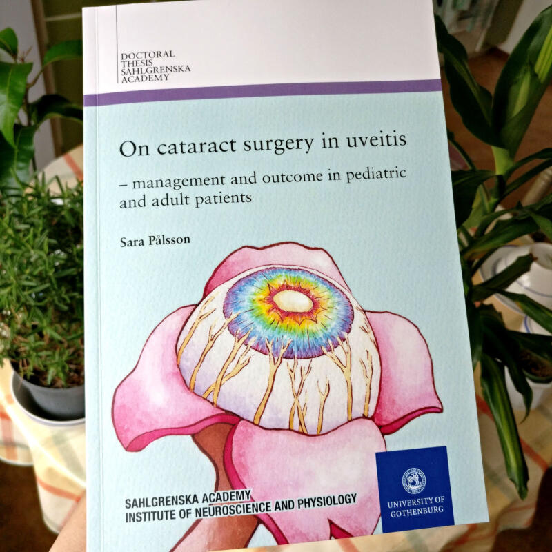 Fotografi av avhandlingen On cataract surgery in uveitis – management and outcome in pediatric and adult patients av Sara Pålsson, med en illustration av ett öga i form av en blomma med mångfärgad regnbågshinna och flera nerver